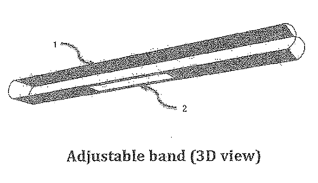 Portable medical device and method for quantitative retinal image analysis through a smartphone