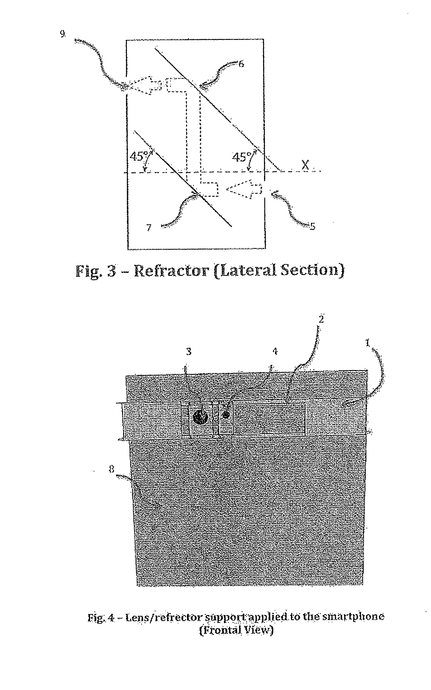 Portable medical device and method for quantitative retinal image analysis through a smartphone