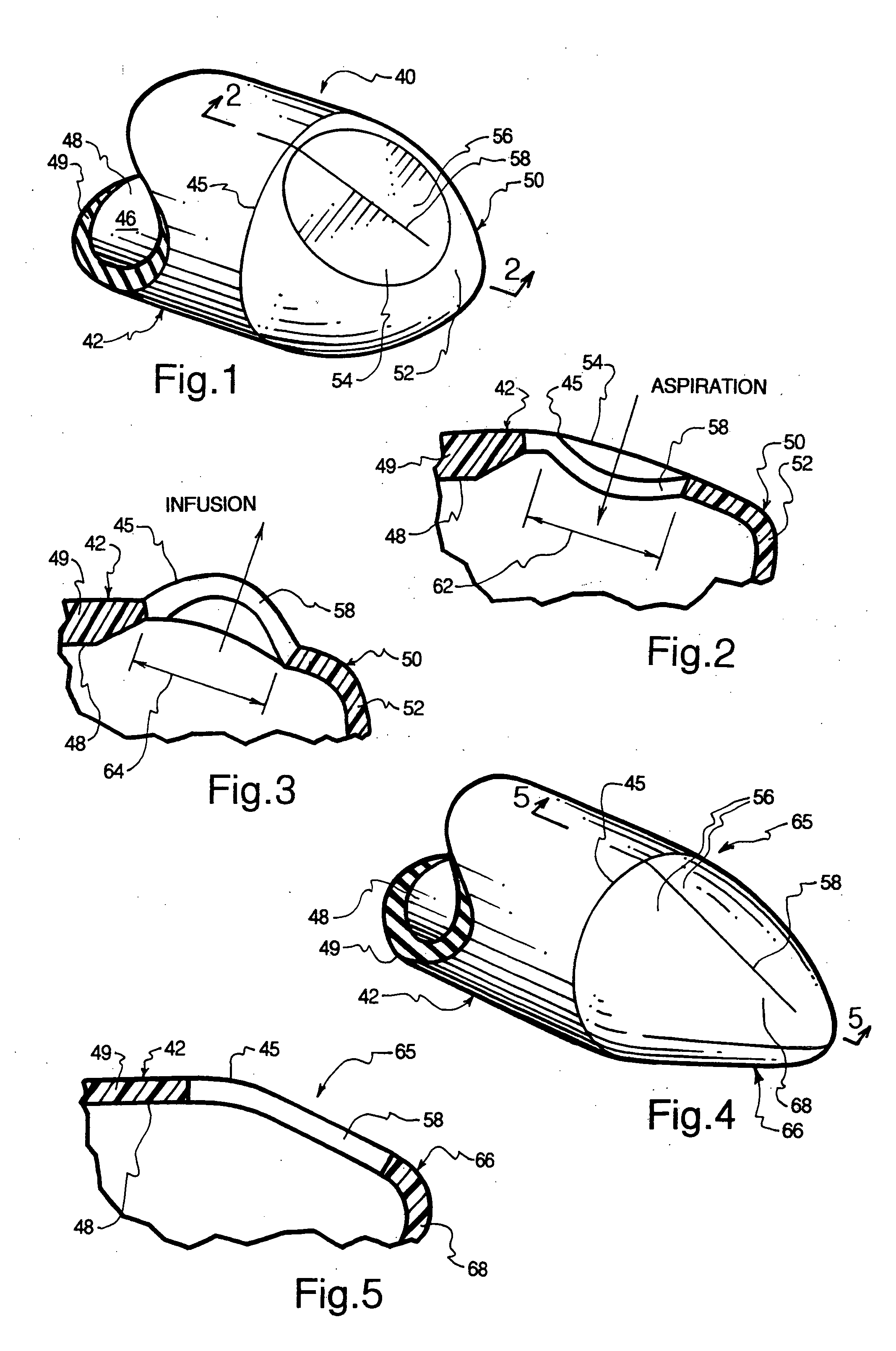 Slit valves bridging between the tip and distal side wall of catheter tubes and methods