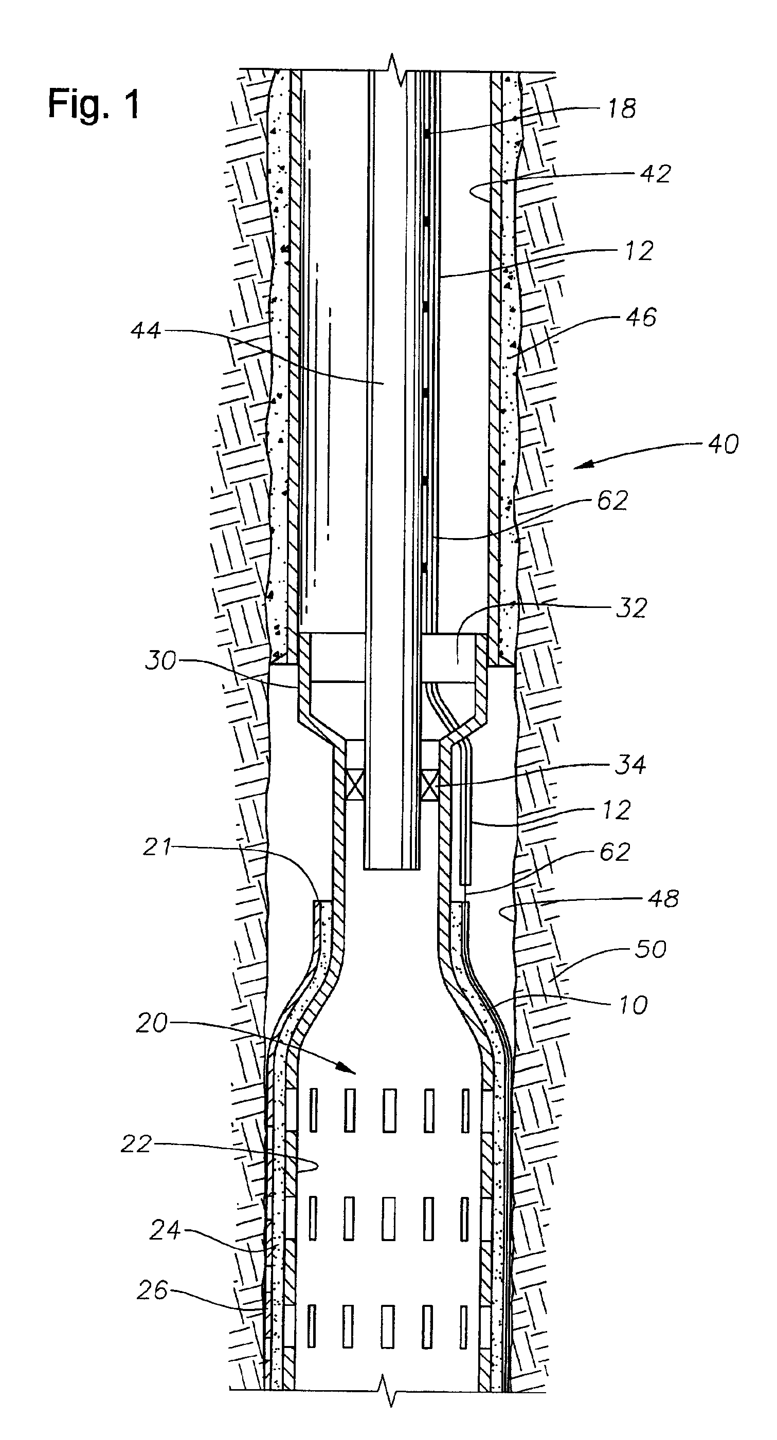 Profiled recess for instrumented expandable components