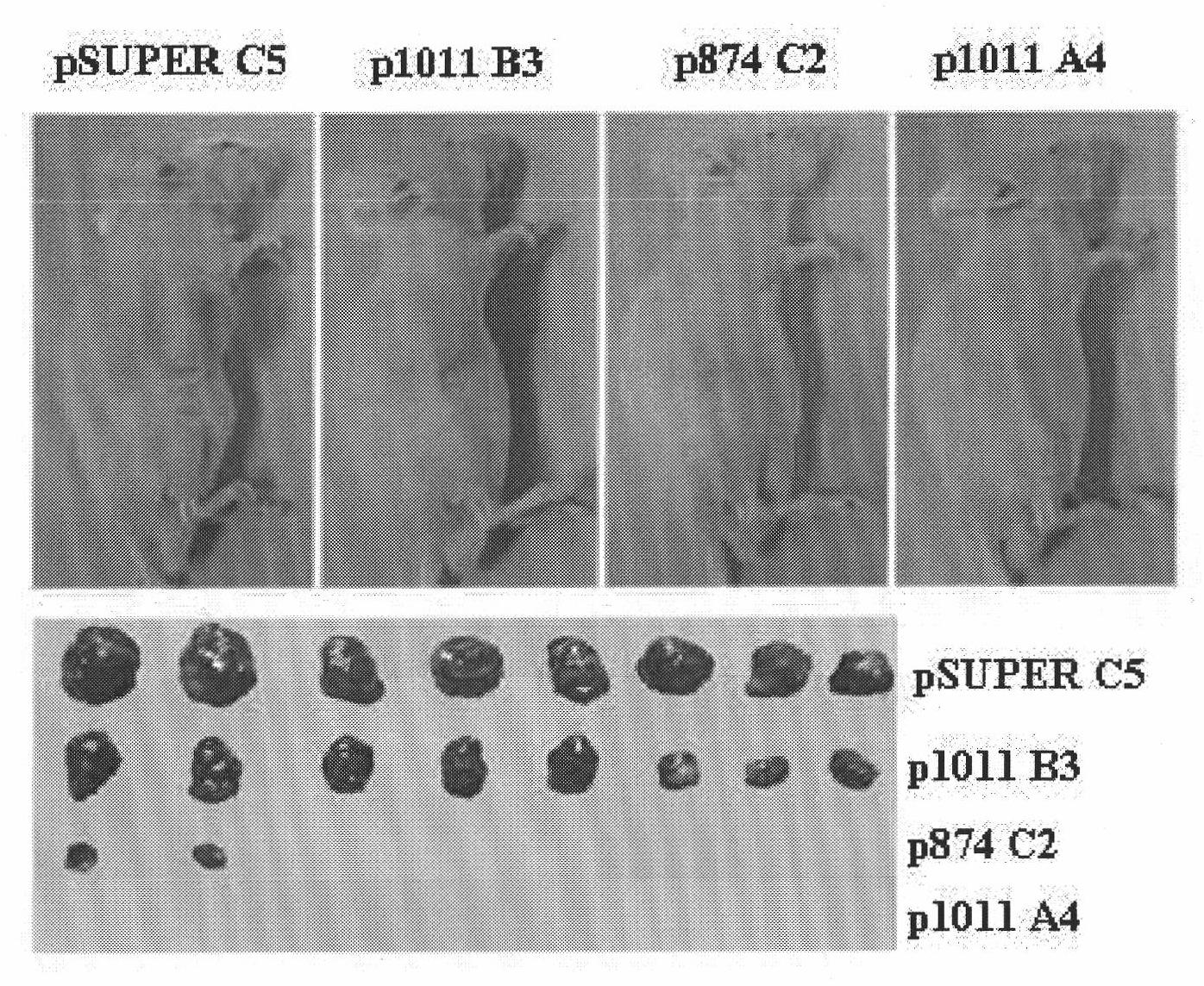 Ribonucleic acid taking liver cancer related gene DLK1 as target spot and application thereof