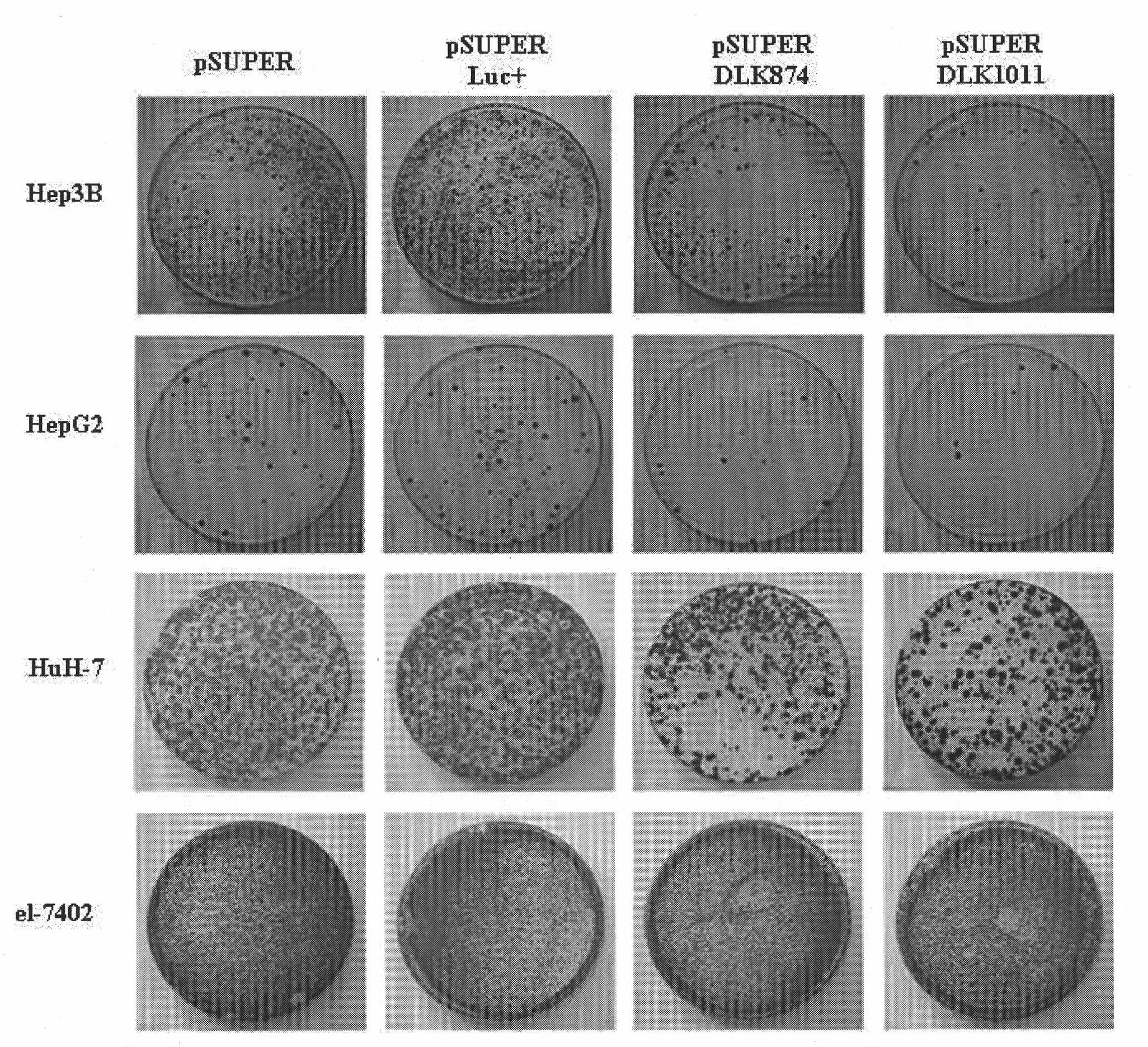 Ribonucleic acid taking liver cancer related gene DLK1 as target spot and application thereof