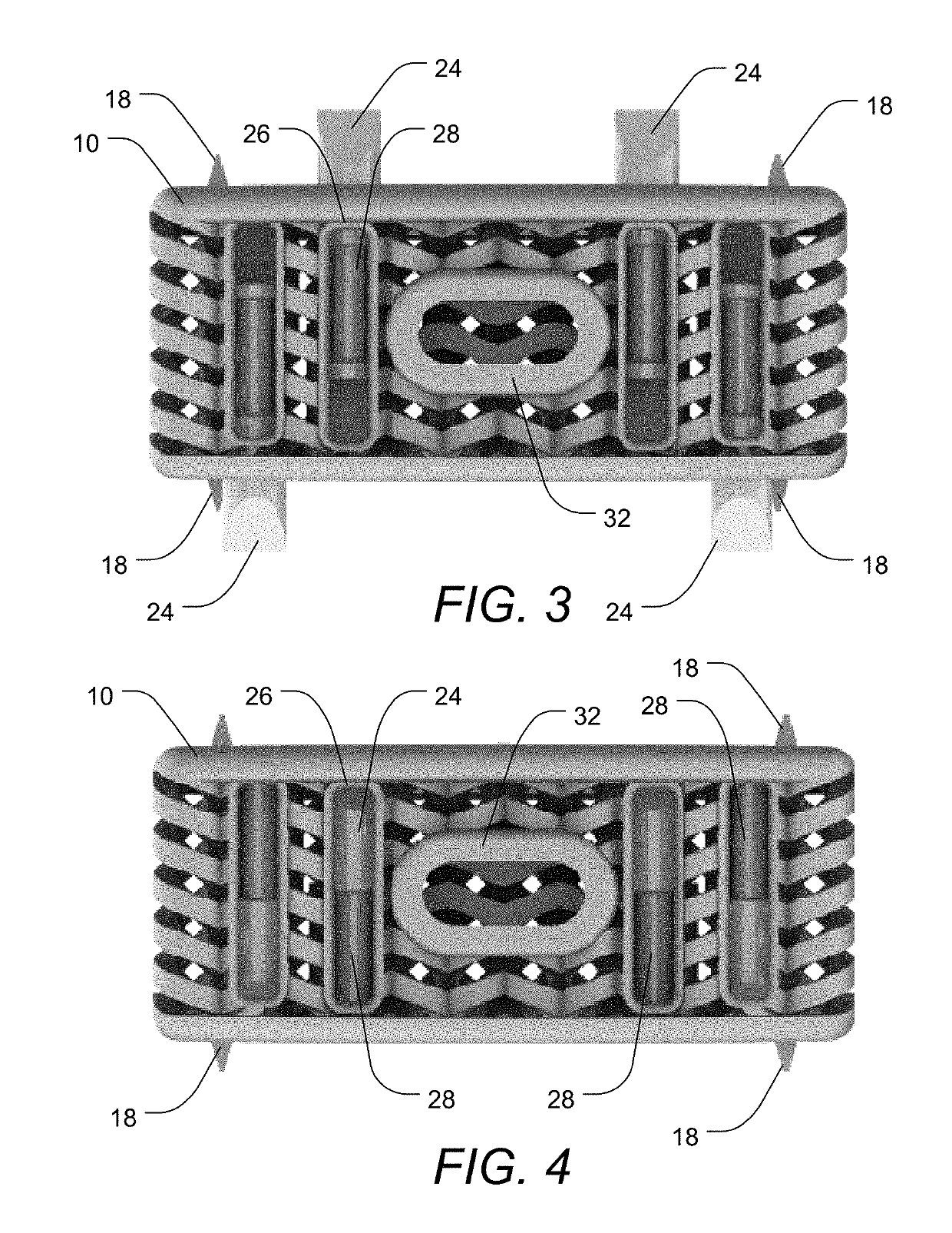 Stand-Alone Interbody Fusion