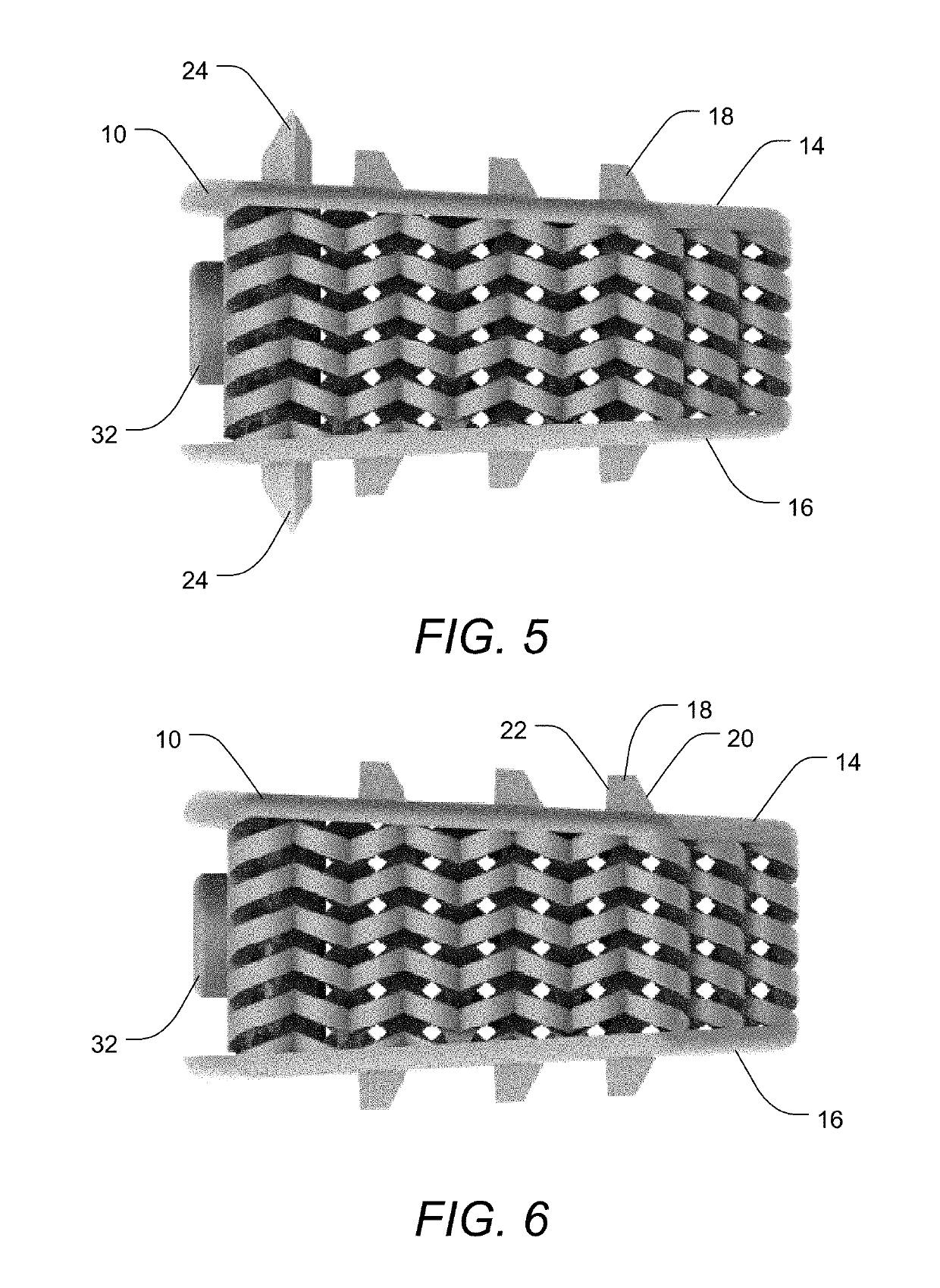 Stand-Alone Interbody Fusion