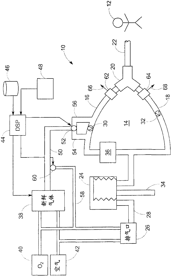 System and method for providing mechanical ventilation support to a patient