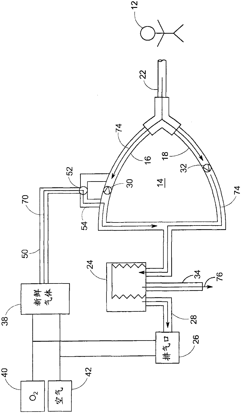 System and method for providing mechanical ventilation support to a patient