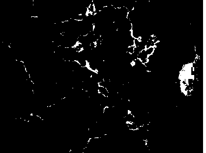 Medicine for treating fatty liver and hyperlipidaemia and preparation process thereof