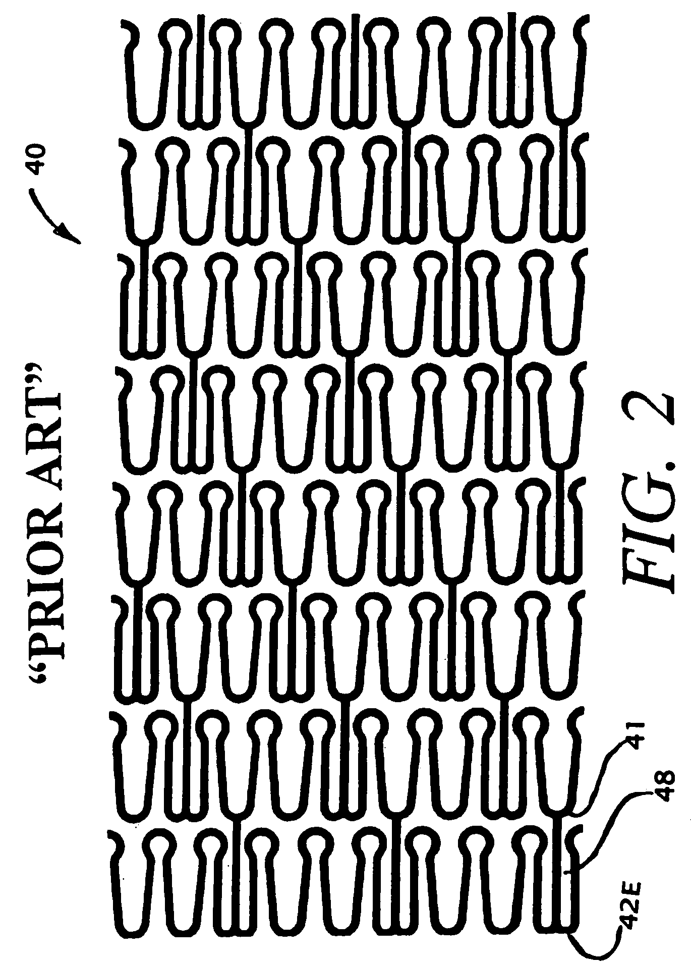 Hybrid stent