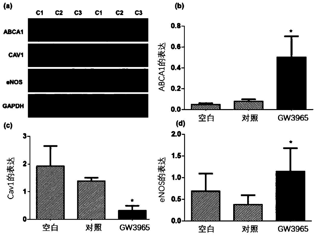 Application of ABCA1 agonist in preparation of medicine for treating eye diseases