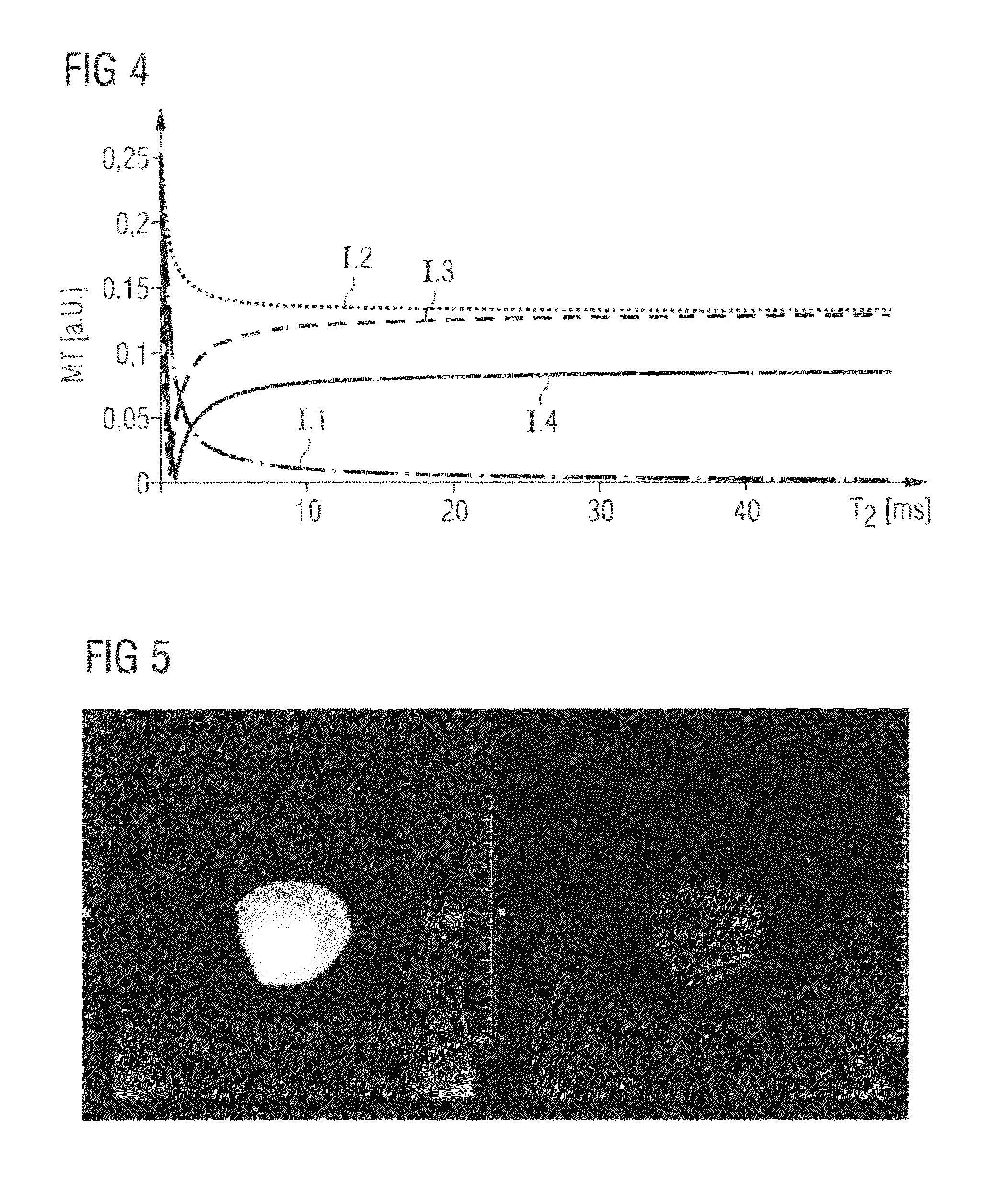 Magnetic resonance system, operating method and control device to generate T<sub>2</sub>-weighted images using a pulse sequence with very short echo times