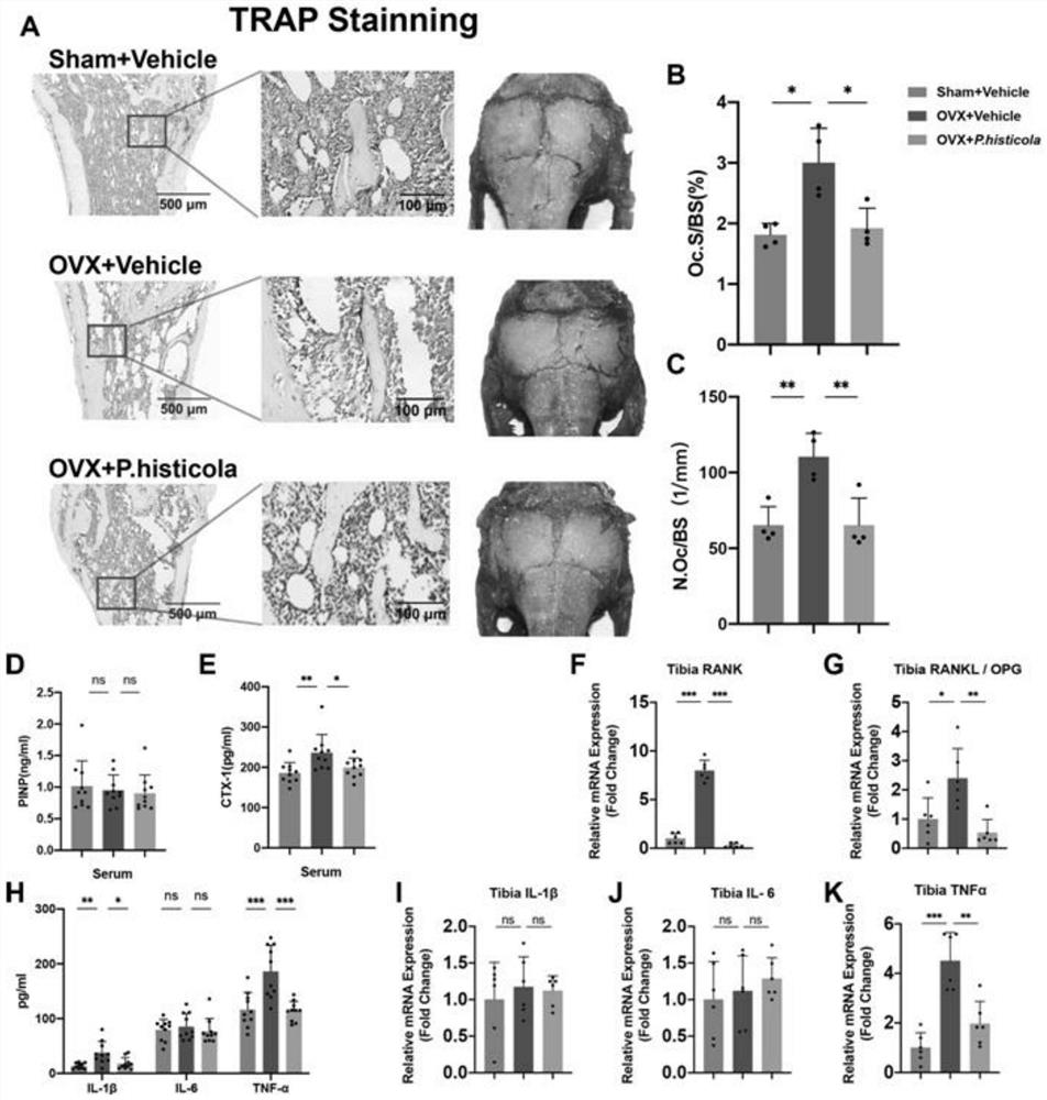 Application of prawnella in treatment or prevention of osteoporosis