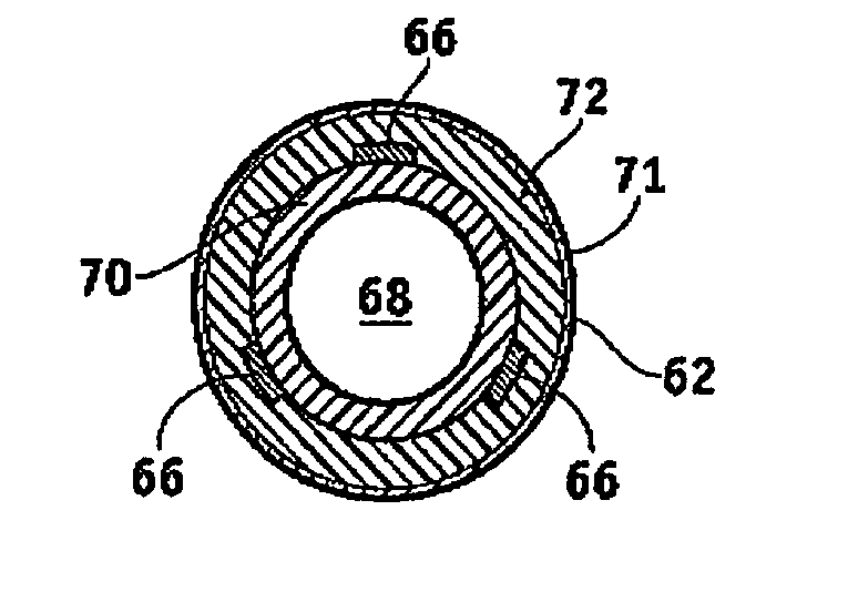 Extensible implantable medical lead