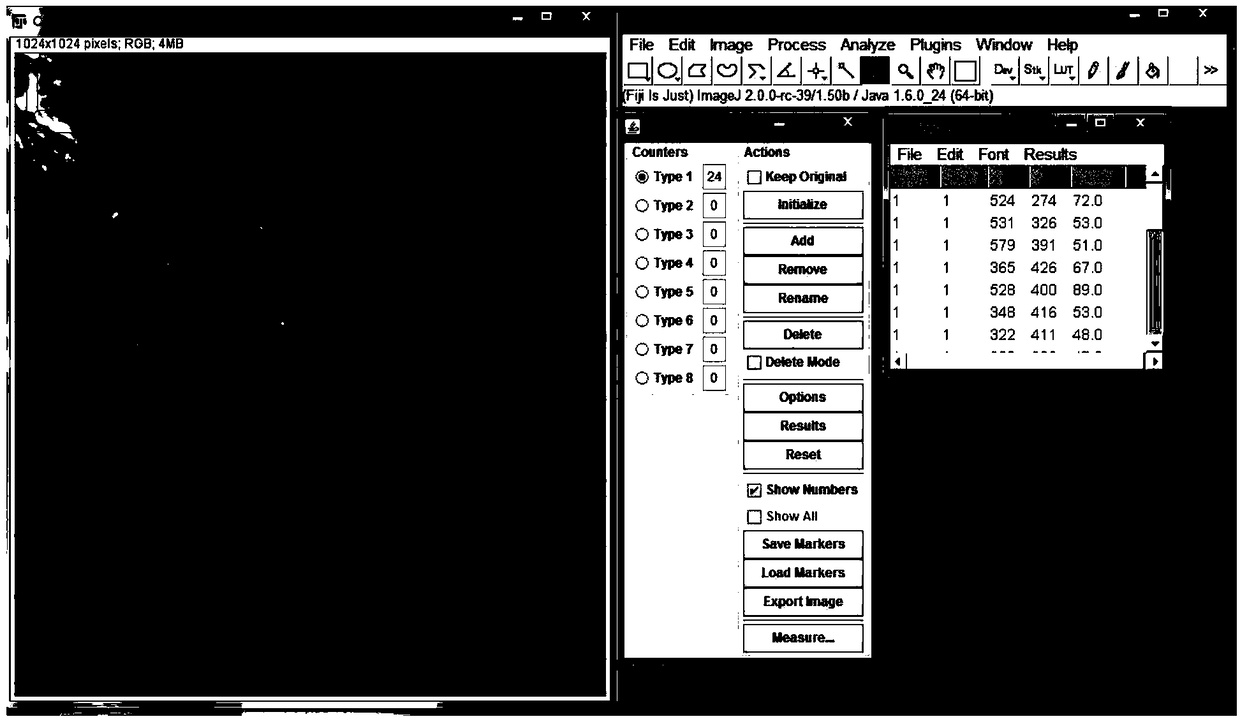 A kit for predicting the risk of pancreatic cancer postoperative recurrence