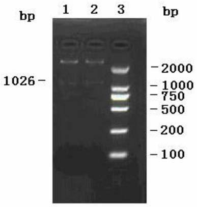 Hybridoma cell line and preparation method thereof, monoclonal antibodies, application and kit