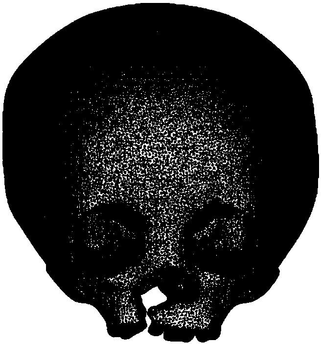 A construction method of a biomechanical simulation model of a cleft lip and palate patient