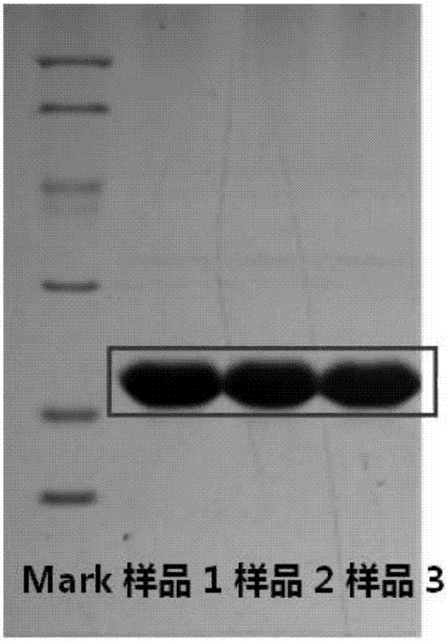 Application of human FGF21 (fibroblast growth factor 21) in preparing medicines for treating stroke