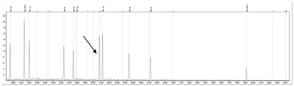 Primer composition for detecting genital tract pathogens through MALDI-TOF MS and application