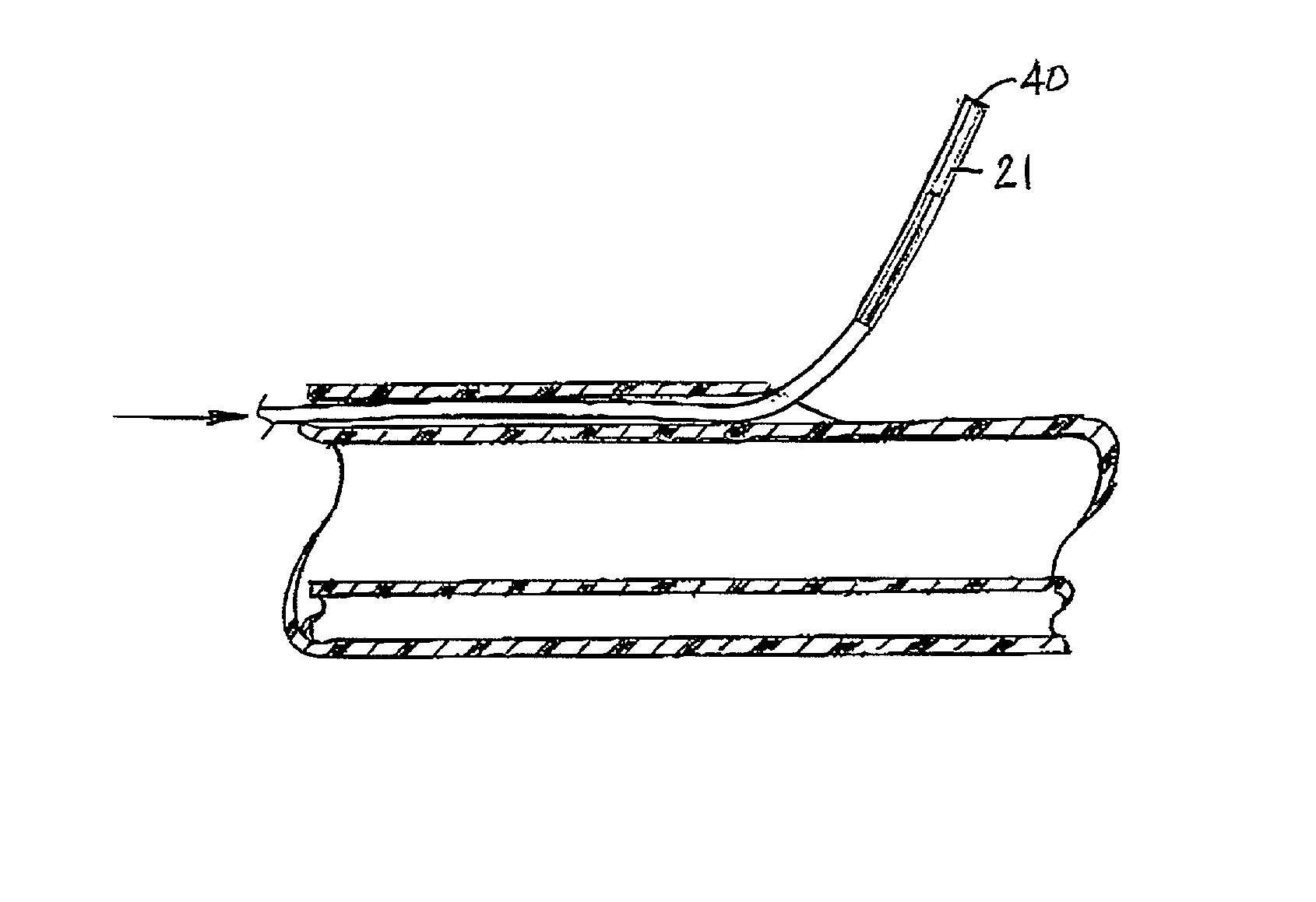 Catheter system with on-board temperature probe