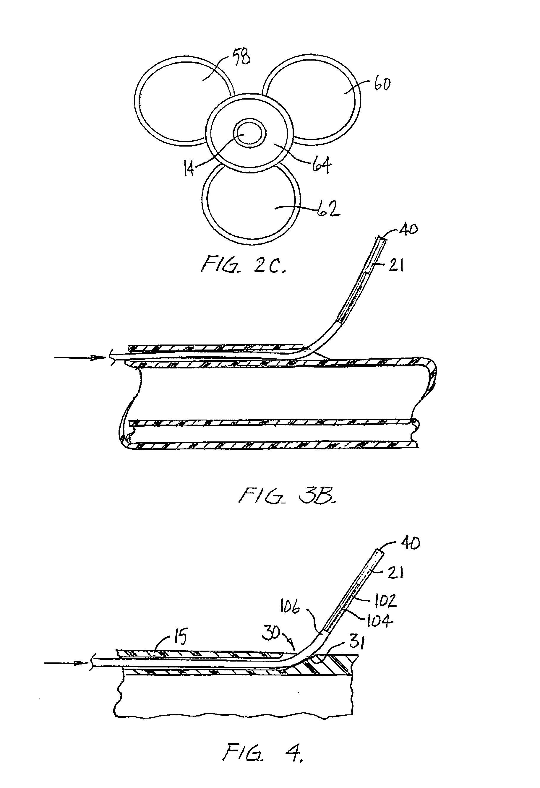 Catheter system with on-board temperature probe