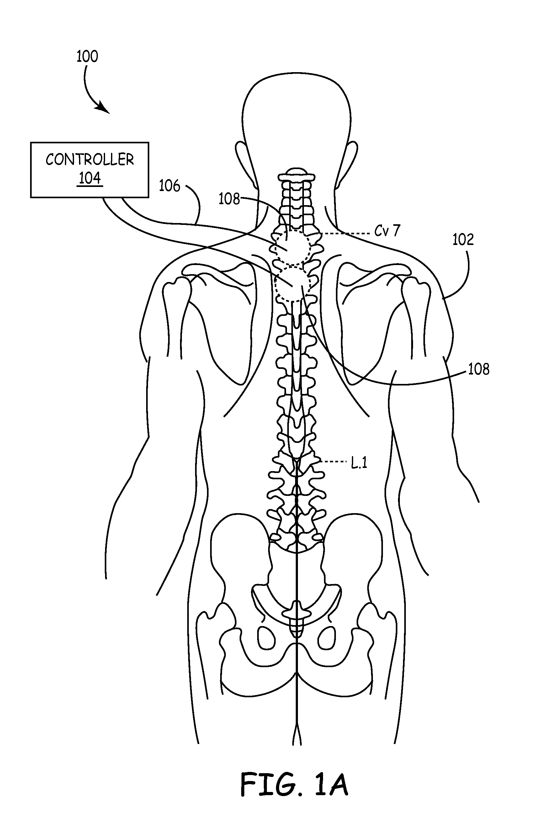 Methods and apparatus for sensing cardiac activity via neurological stimulation therapy system or medical electrical lead