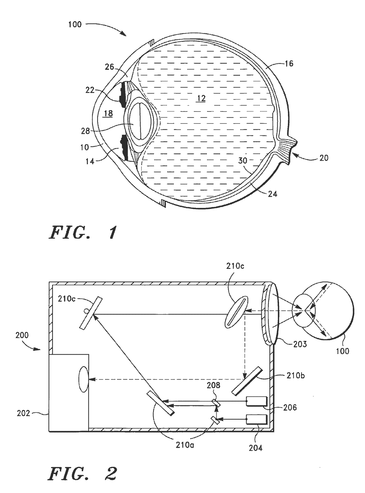 Laser treatment of an eye structure or a body surface from a remote location