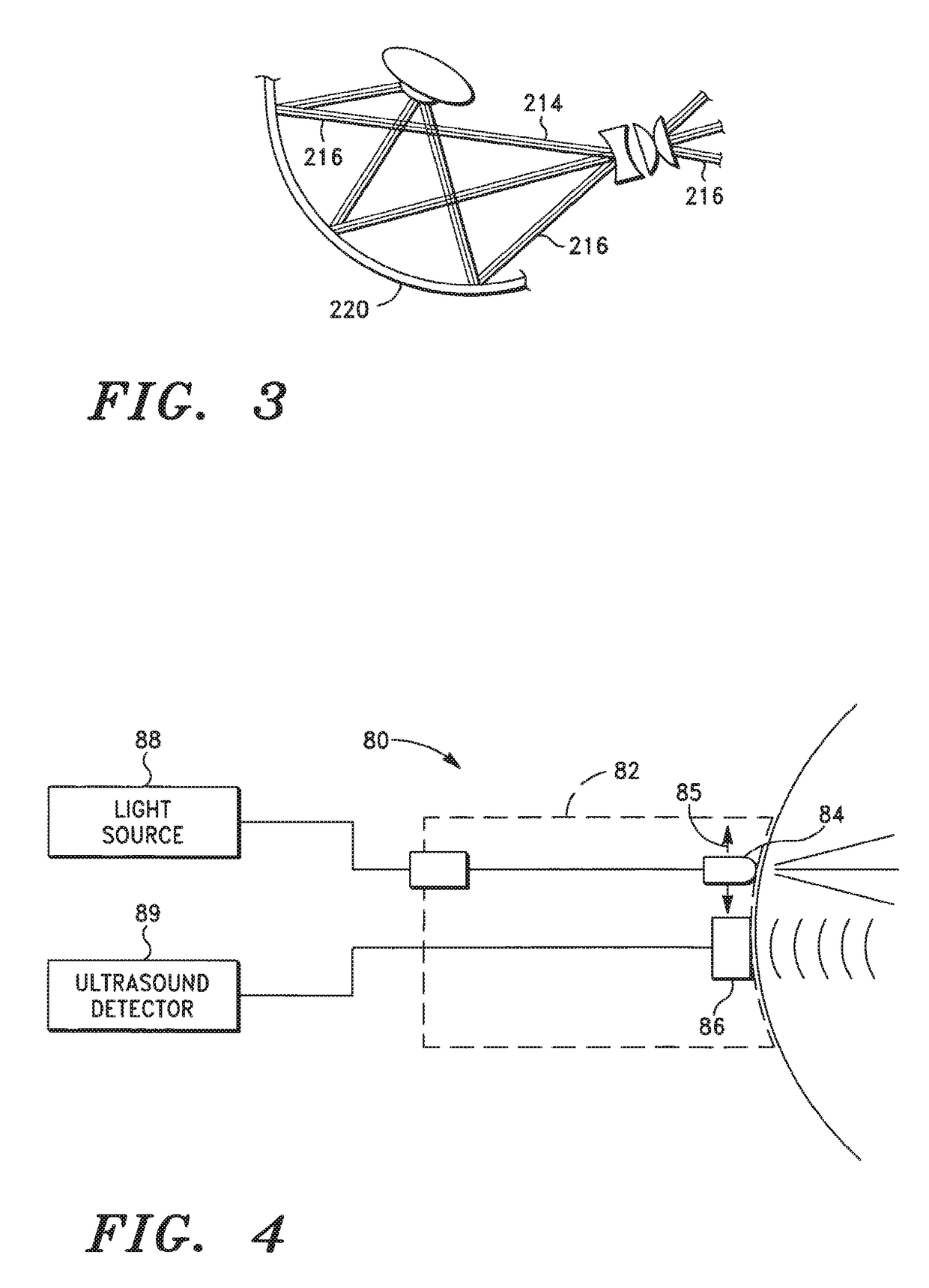 Laser treatment of an eye structure or a body surface from a remote location