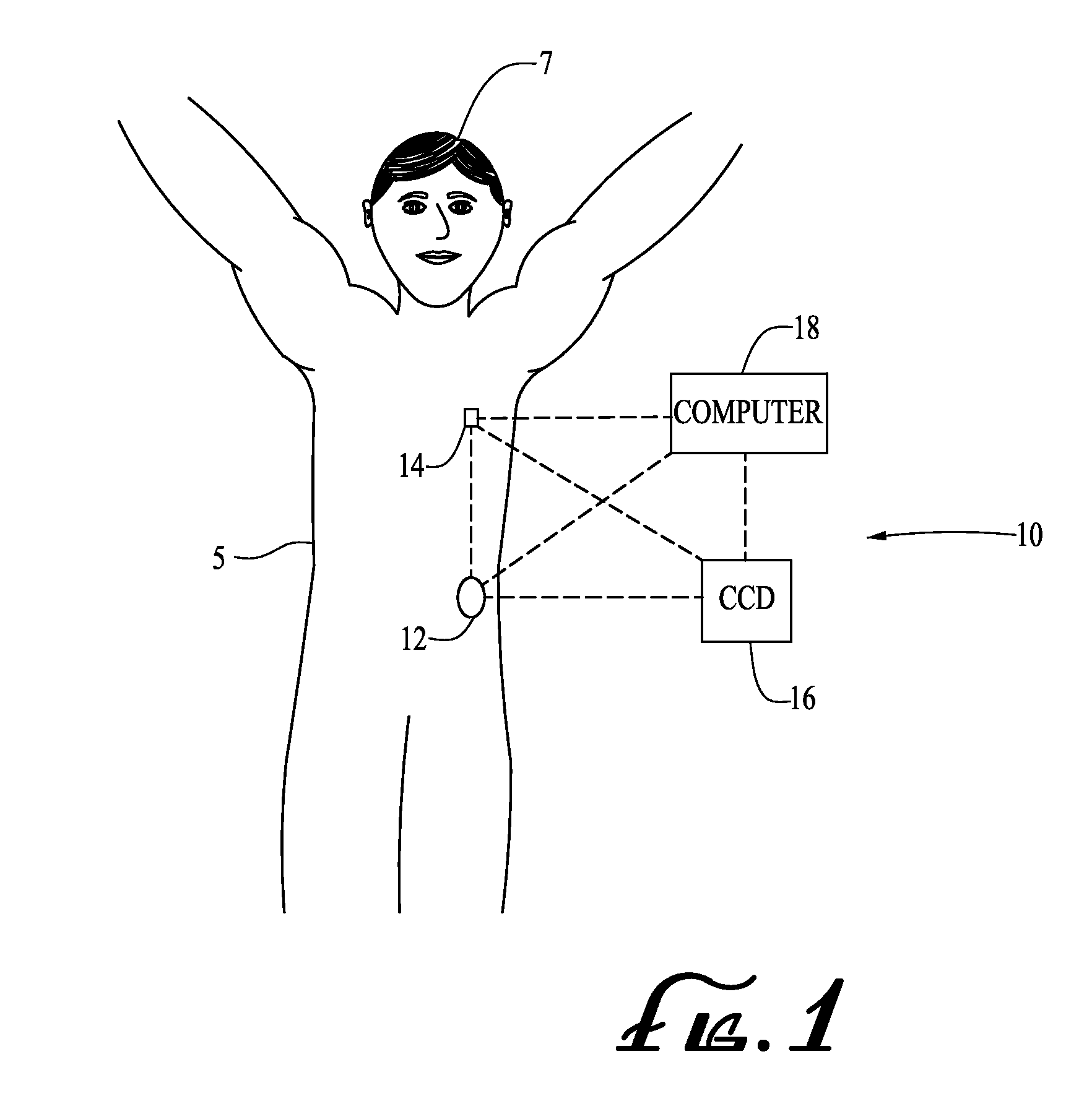 Insertion device systems and methods