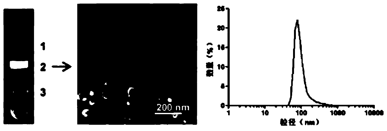 Preparation method of composite for treating brain glioma