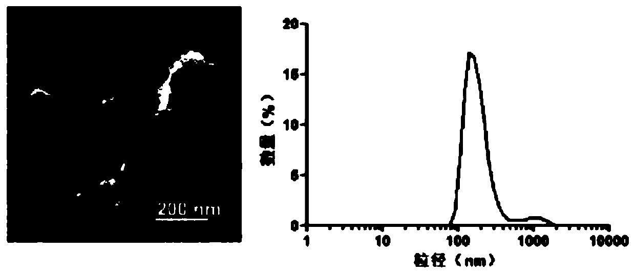 Preparation method of composite for treating brain glioma