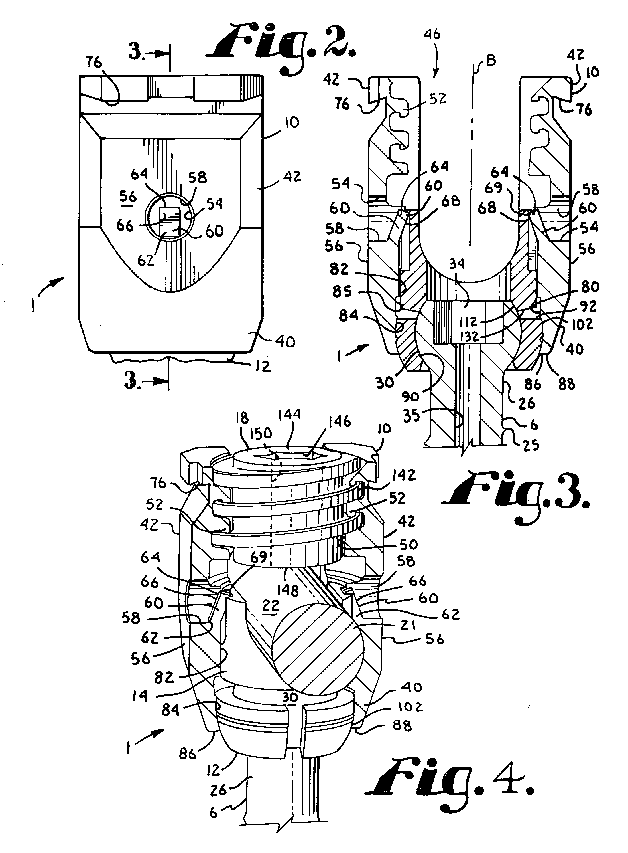 Polyaxial bone screw with spherical capture, compression and alignment and retention structures