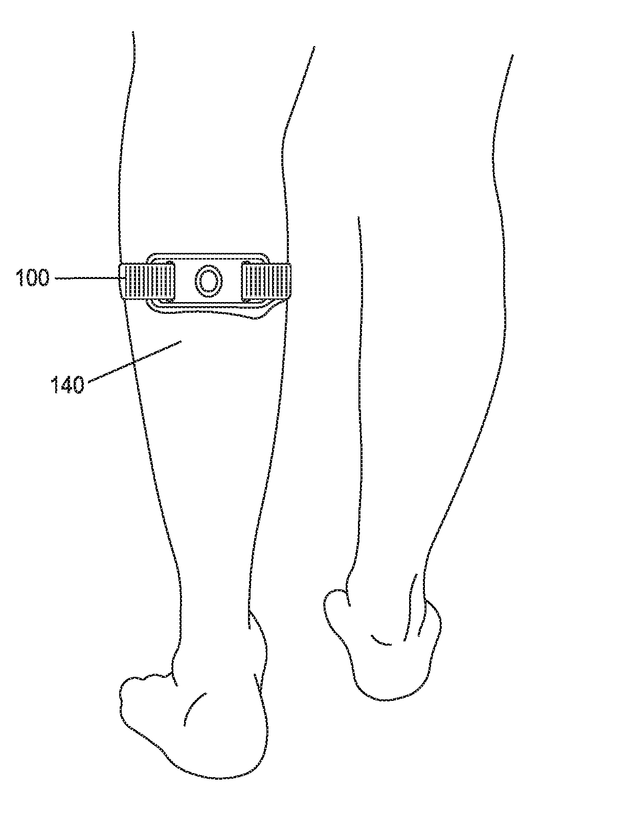 Measuring the “on-skin” time of a transcutaneous electrical nerve stimulator (TENS) device in order to minimize skin irritation due to excessive uninterrupted wearing of the same