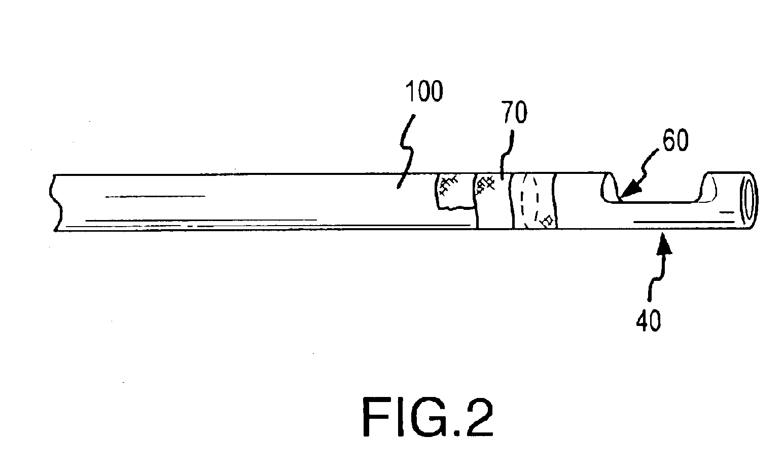 Flexible endoscope capsule