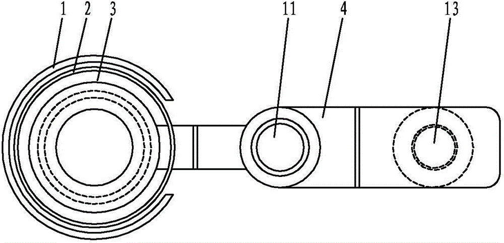 Centrifugal sputum case for induced sputum tubercle bacillus detection