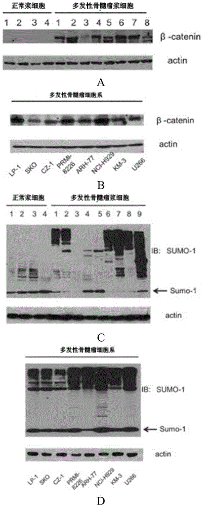 MM (multiple myeloma)-resistant small-interference RNA (ribonucleic acid) and application thereof