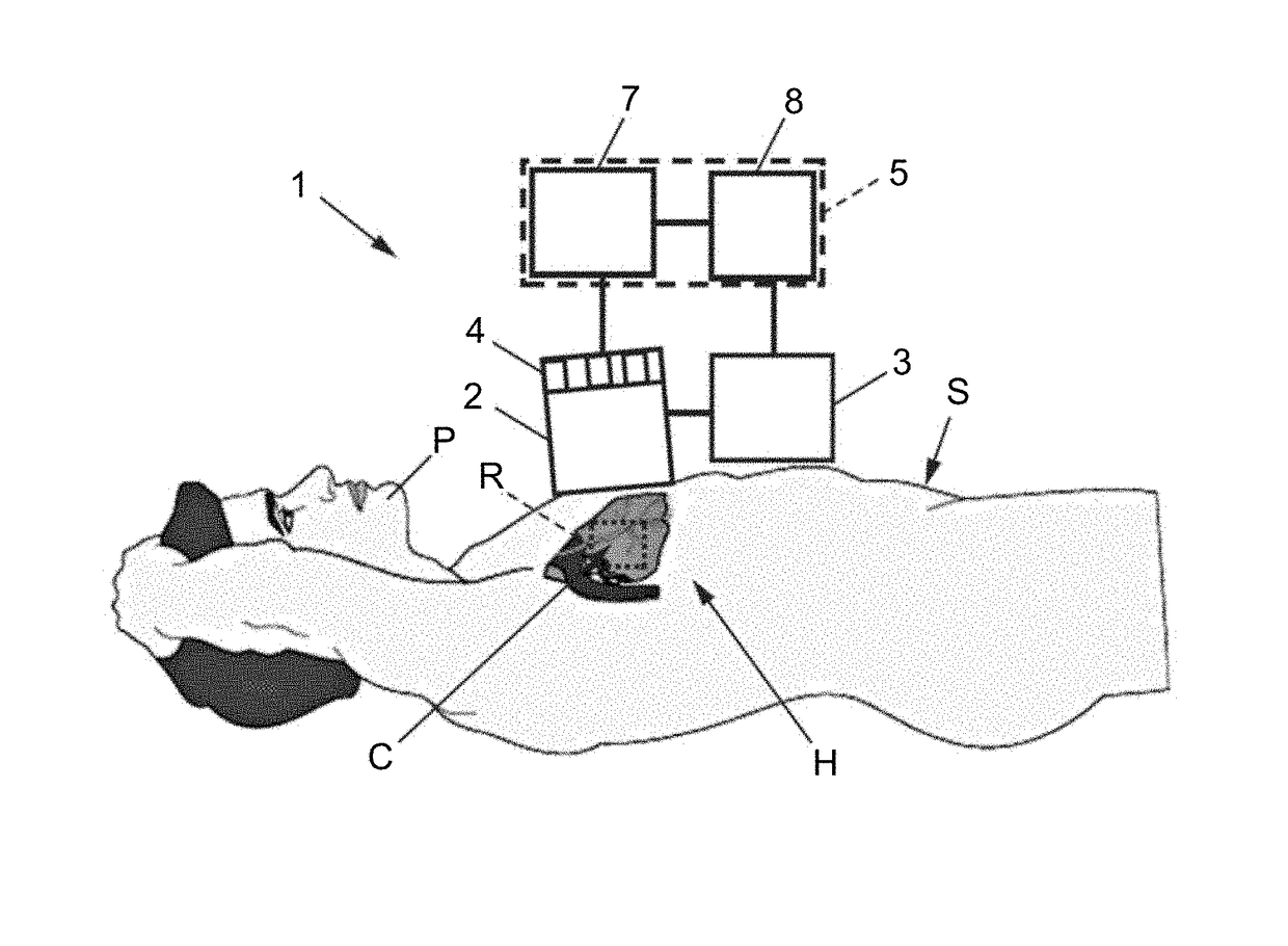 Method and apparatus for treating valvular disease