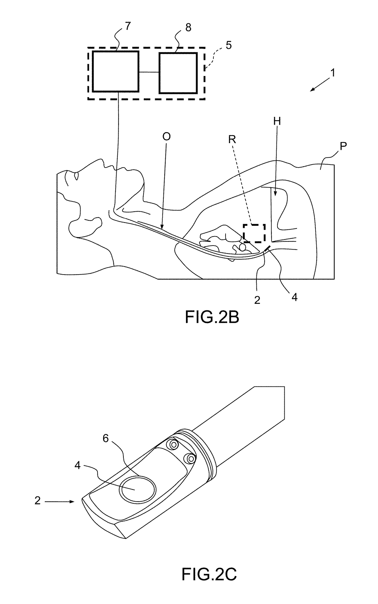 Method and apparatus for treating valvular disease