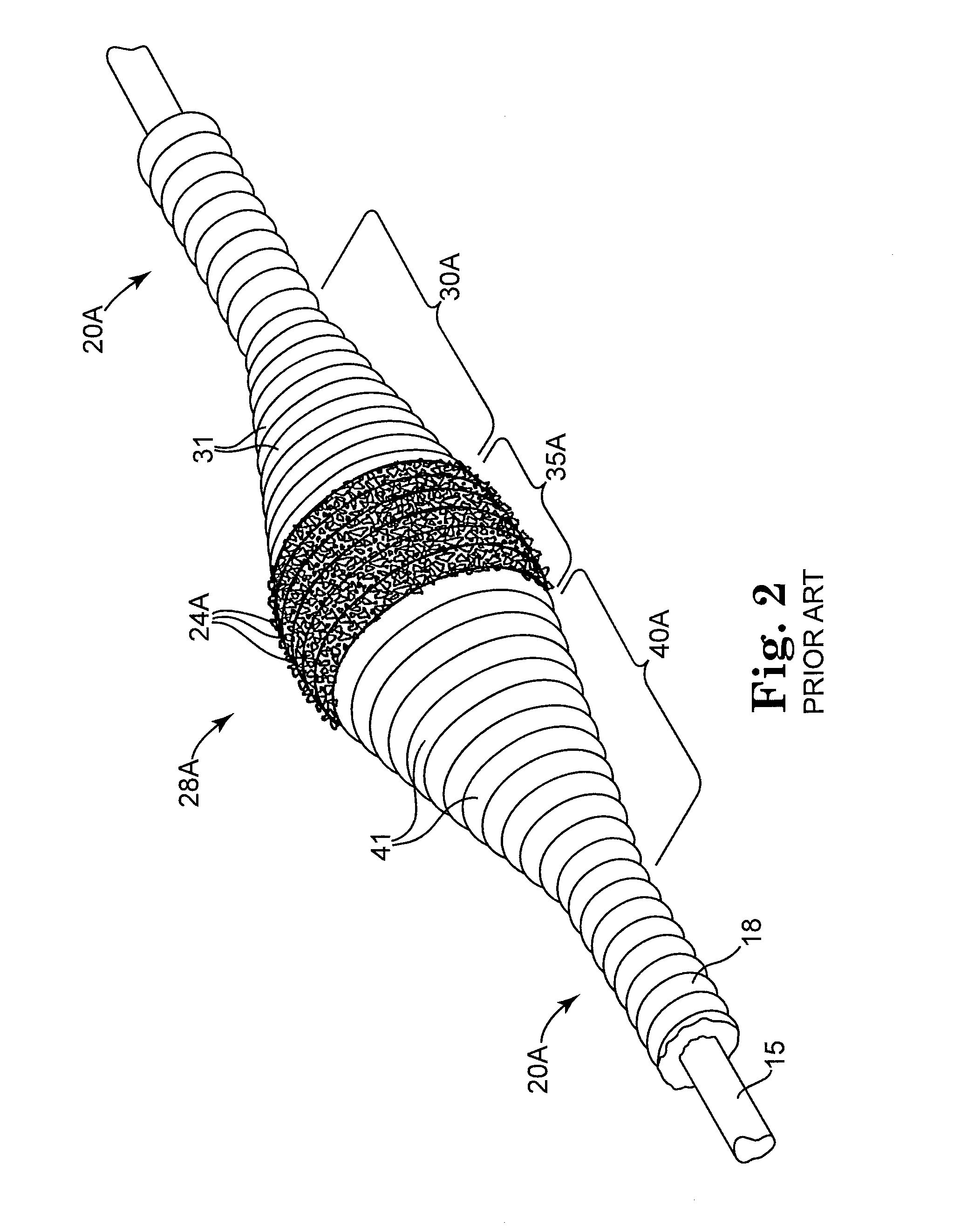 Eccentric abrading and cutting head for high-speed rotational atherectomy devices