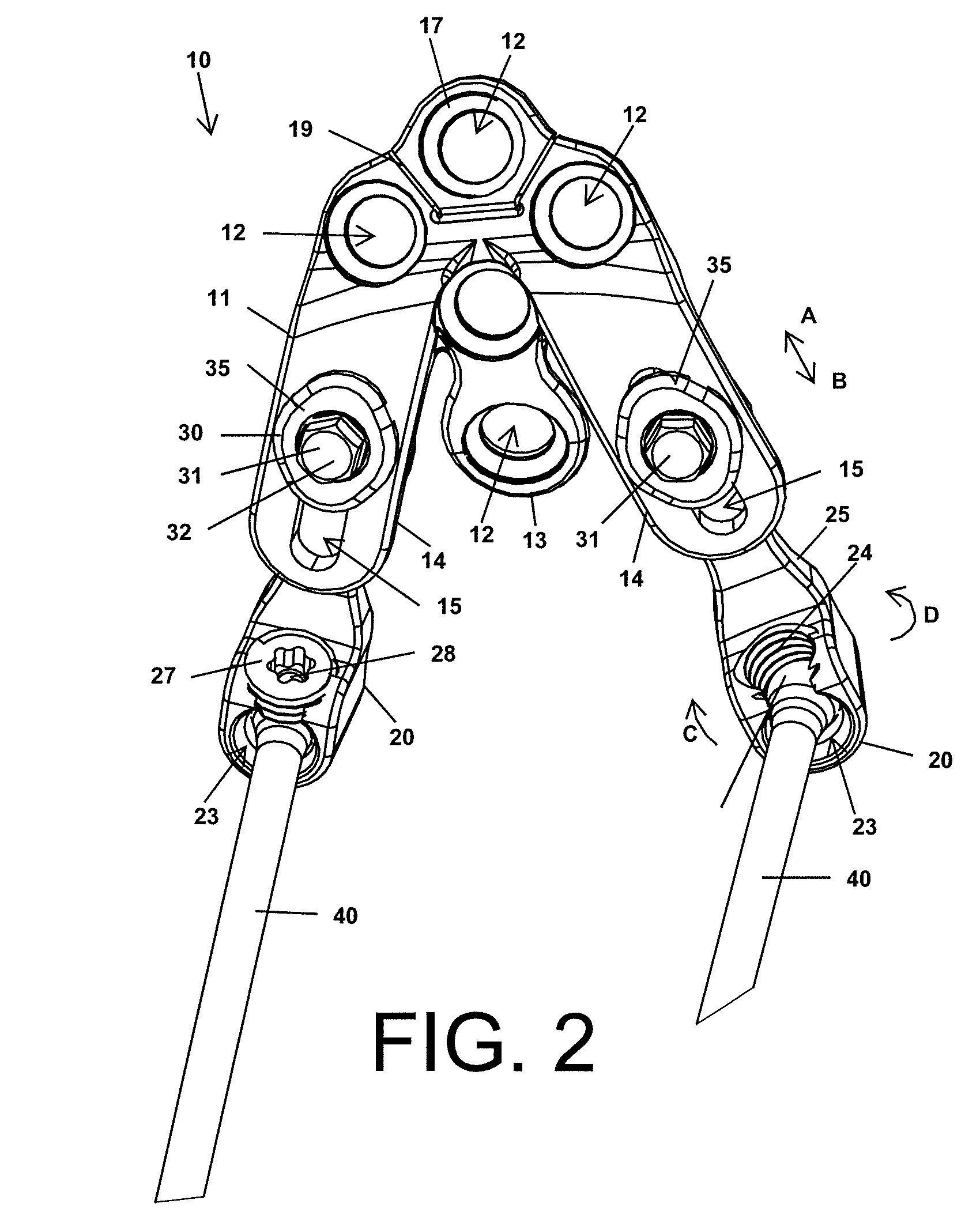 Occipital Plate for Spinal Fusion