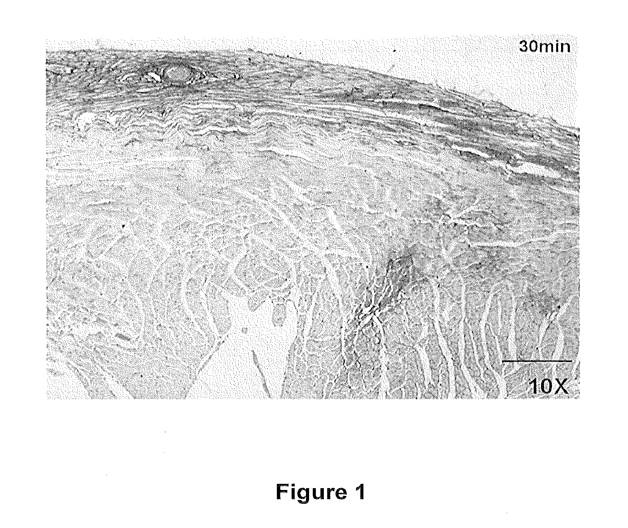 Methods of reducing myocardial injury following myocardial infarction