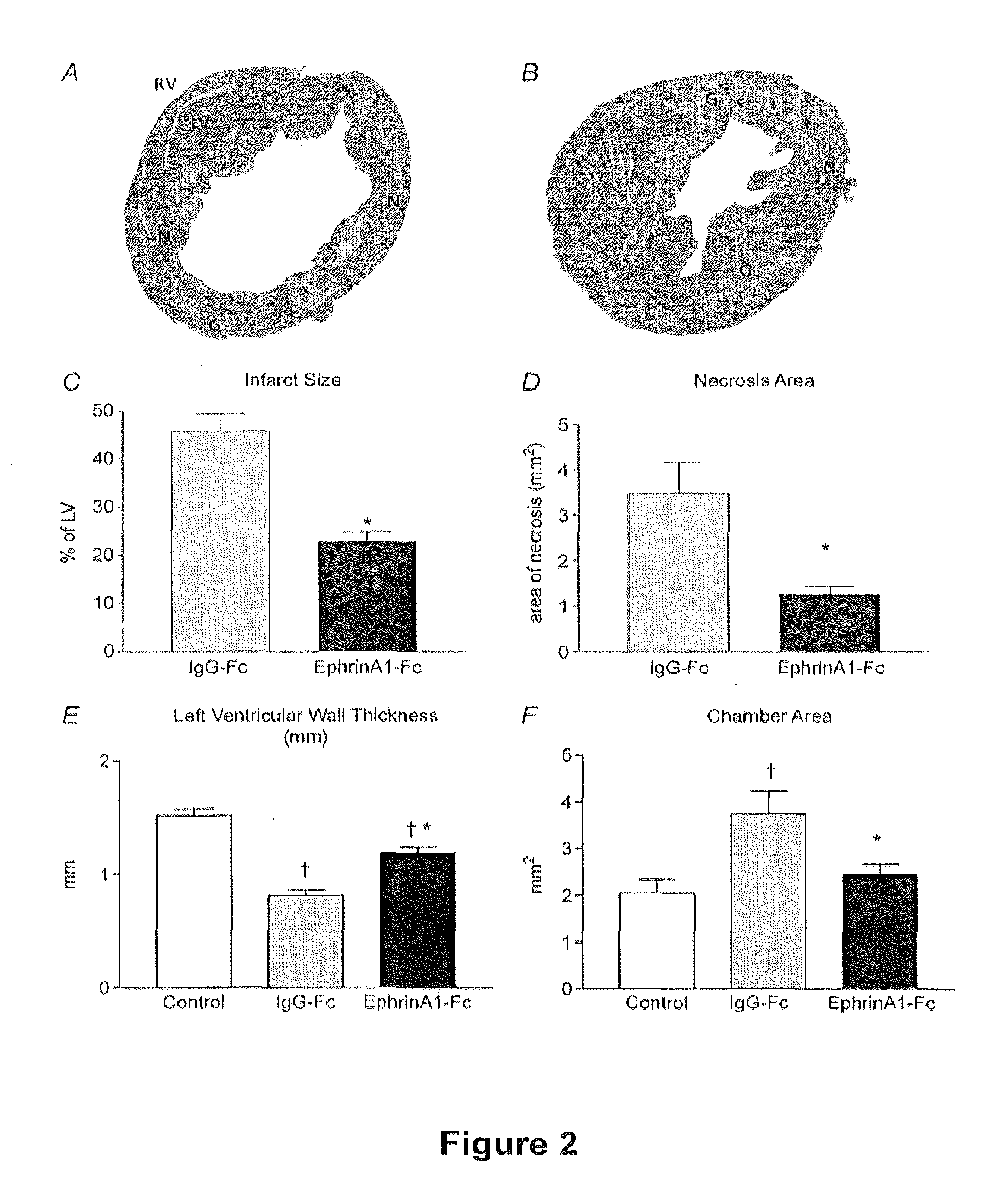 Methods of reducing myocardial injury following myocardial infarction