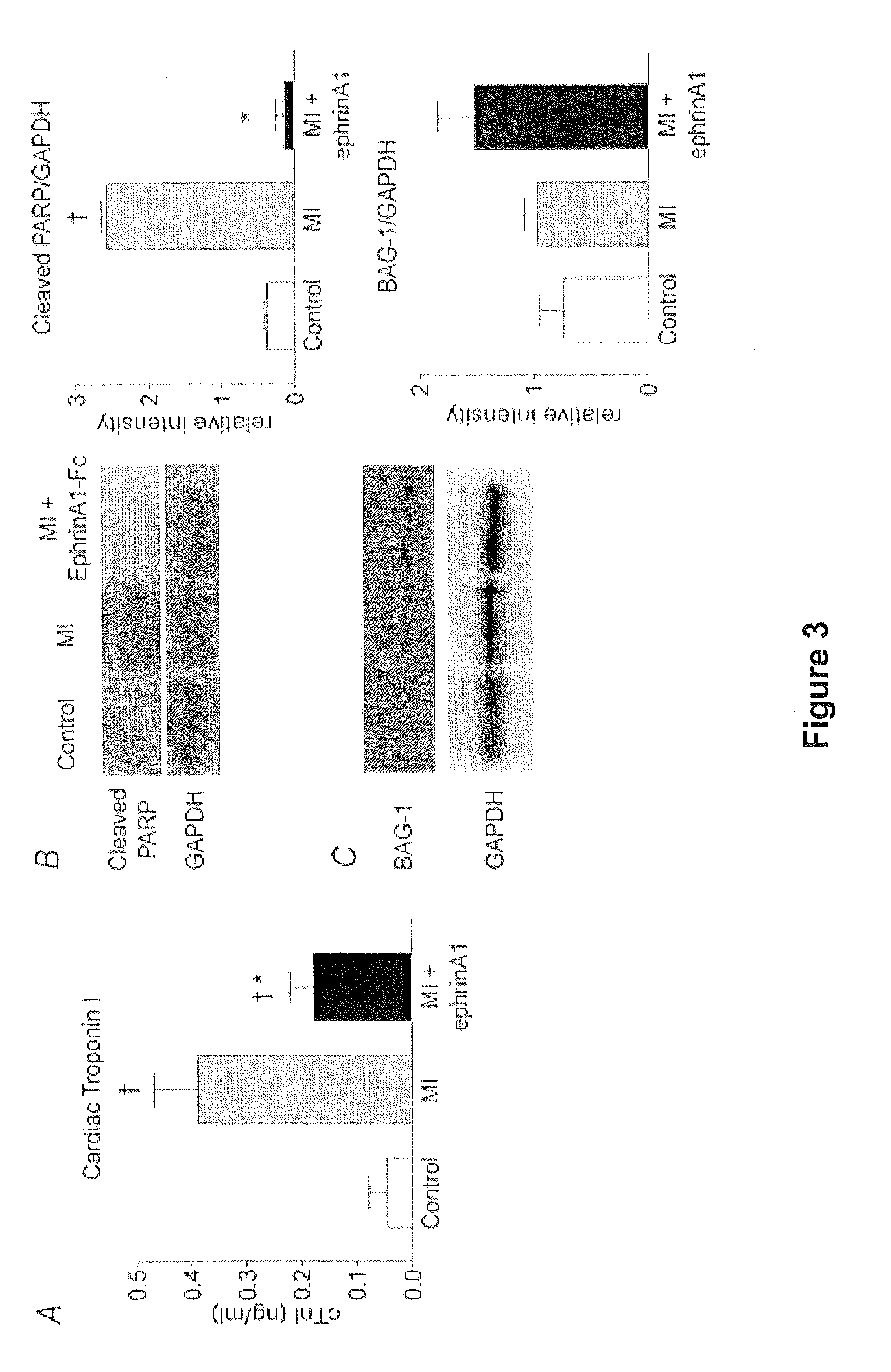 Methods of reducing myocardial injury following myocardial infarction