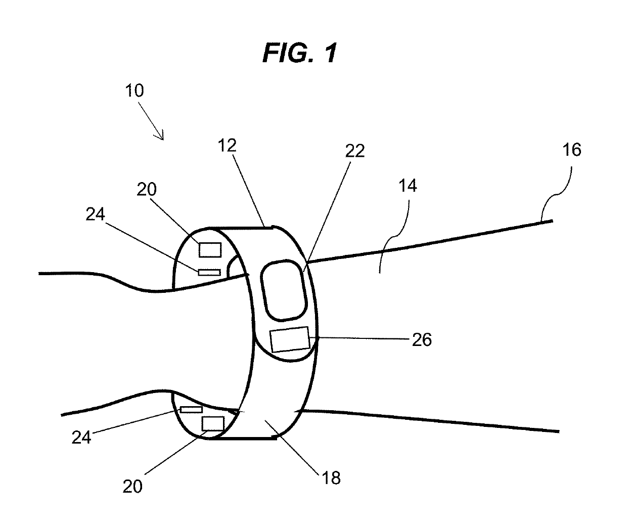 Wearable Ultraviolet Light Phototherapy Device