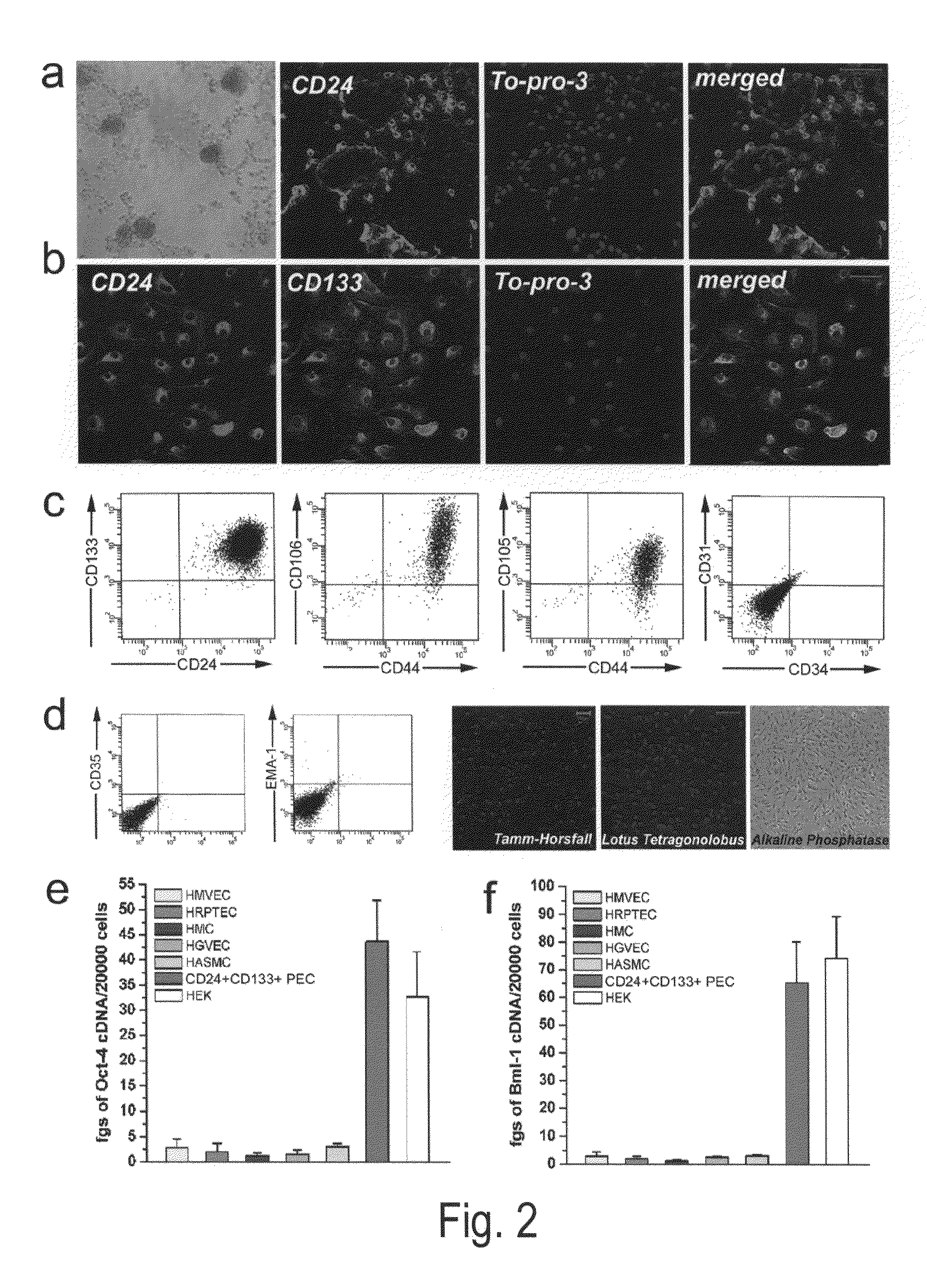 Kidney-Derived Stem Cell Population, Identification and Therapeutic Use