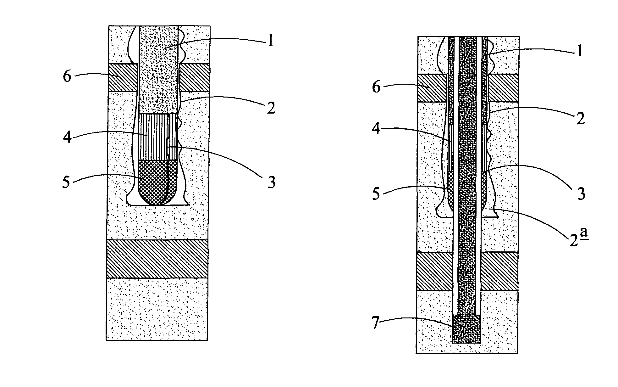 Running bore-lining tubulars