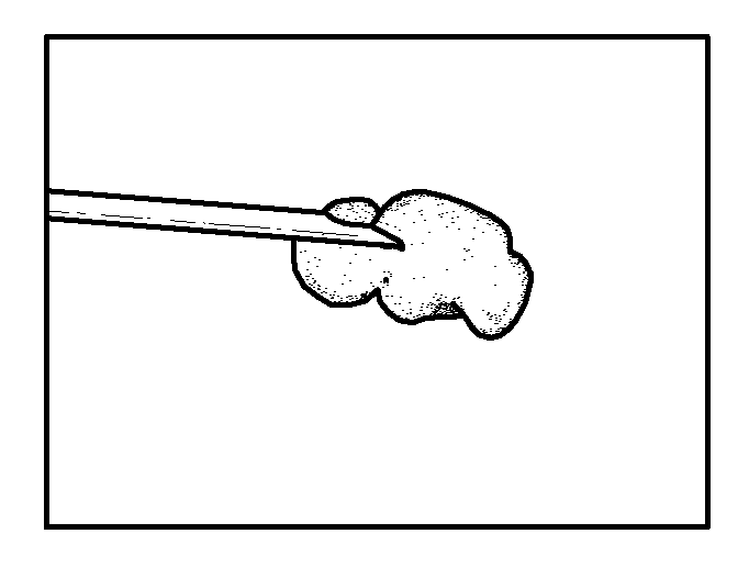 Bone treatment systems and methods