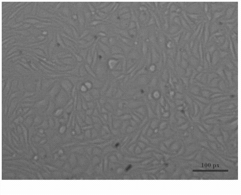 Alkyl modified chitosan/mesoporous silicon dioxide composite quick hemostatic powder and preparation method thereof