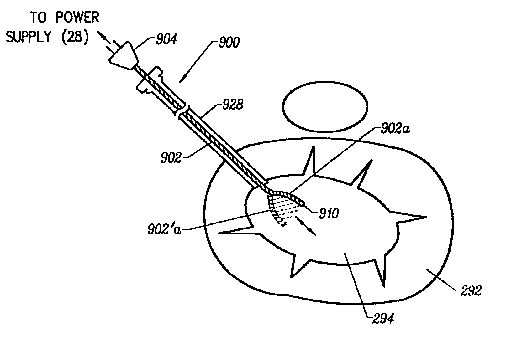 Methods for repairing damaged intervertebral discs