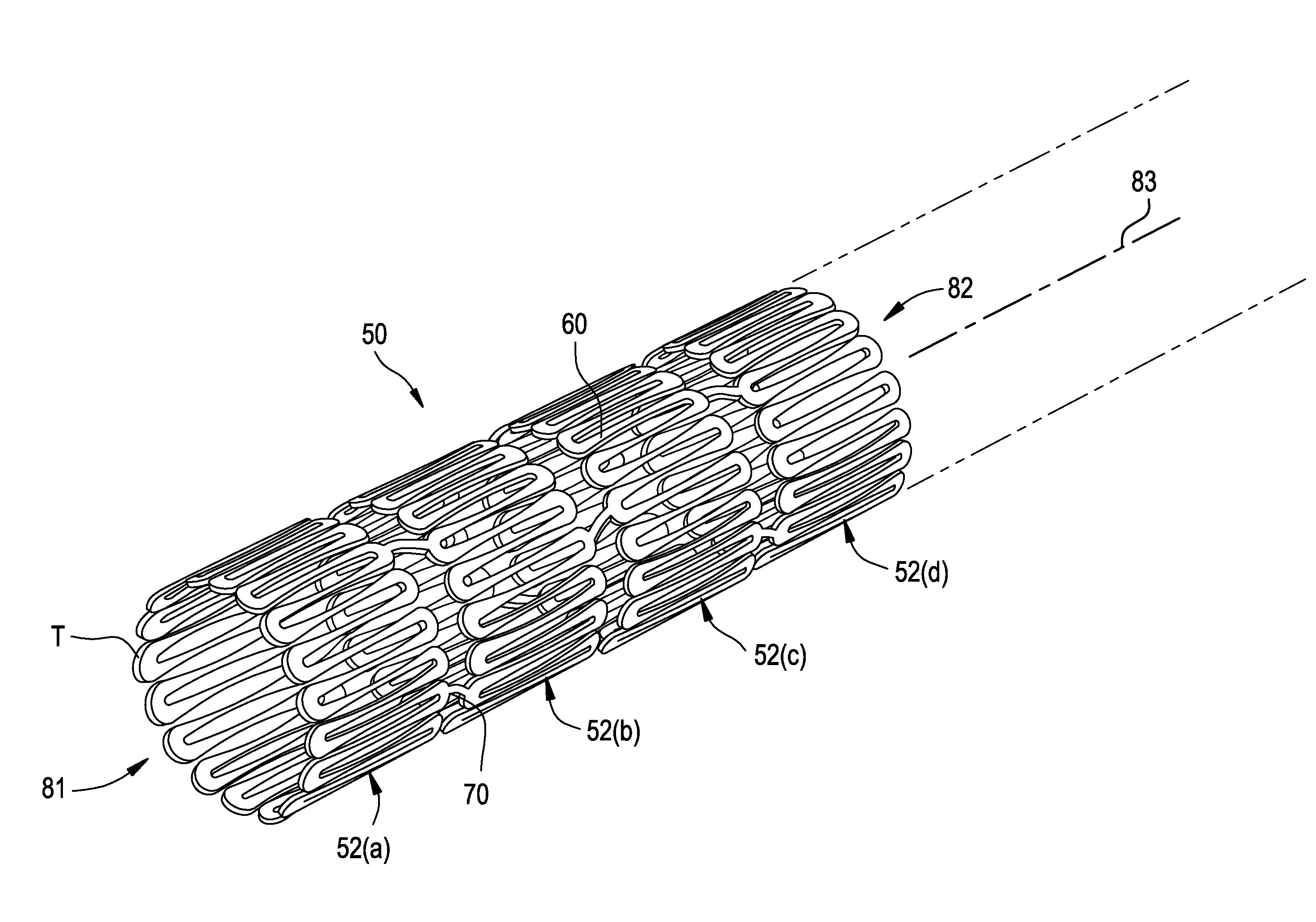 Intravascular stent having imrproved design for loading and deploying