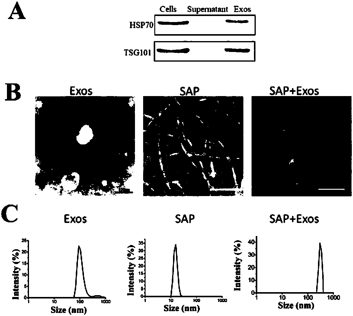 Polypeptide hydrogel with slow-release exosomes and preparation method and application thereof