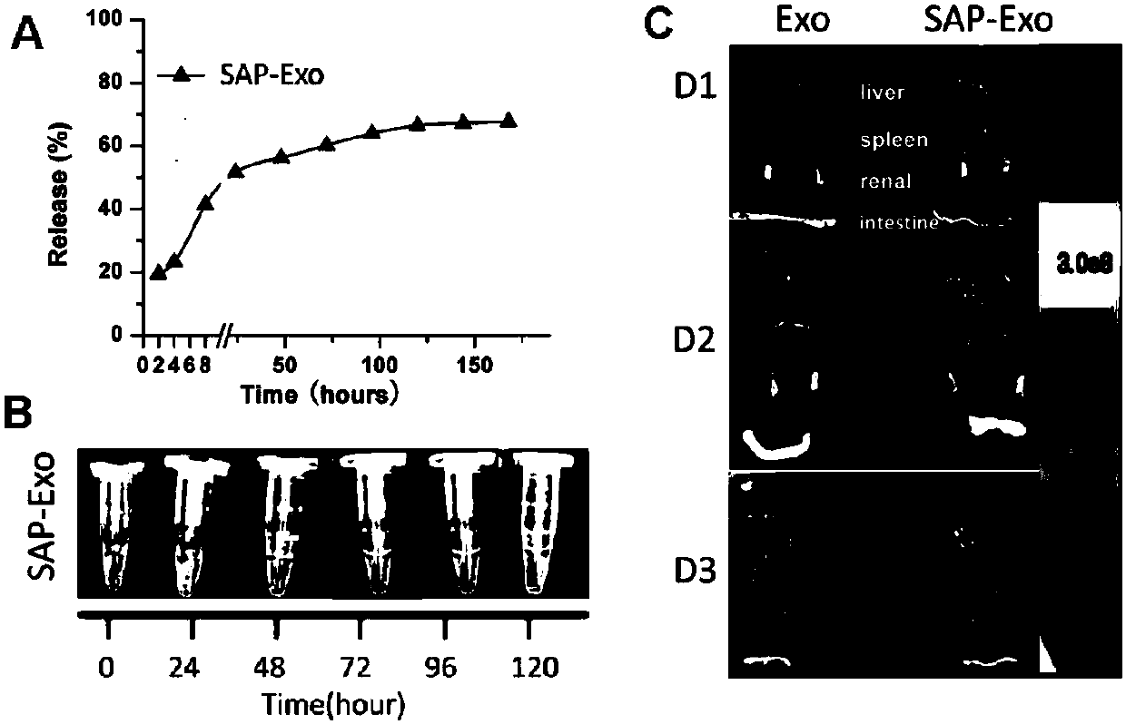 Polypeptide hydrogel with slow-release exosomes and preparation method and application thereof